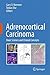 Adrenocortical Carcinoma by Gary D. Hammer