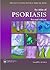An Atlas of Psoriasis