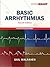 Basic Arrhythmias