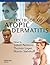 Textbook of Atopic Dermatitis