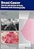 Breast Cancer: The Art And Science Of Early Detection With Mamography: Perception, Interpretation, Histopatholigic Correlation