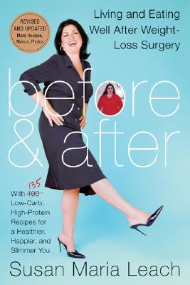 Before & After: Living and Eating Well After Weight-Loss Surgery (Paperback)