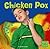 Chicken Pox (First Facts)