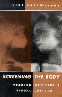 Screening The Body: Tracing Medicine’s Visual Culture (Paperback)