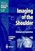 Imaging of the Shoulder: Techniques and Applications (Medical Radiology)