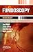 Fundoscopy Made Easy