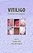Vitiligo: Problems and Solutions (Basic and Clinical Dermatology)