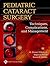 Pediatric Cataract Surgery:...