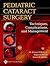 Pediatric Cataract Surgery by Rupal H. Trivedi