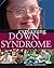 Explaining Down Syndrome