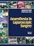 Anaesthesia in Laparoscopic Surgery
