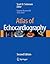Atlas of Echocardiography
