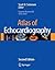 Atlas of Echocardiography by Scott D. Solomon