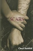 Scars