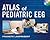 Atlas of Pediatric EEG (Atlas Series)