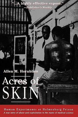 Acres of Skin: Human Experiments at Holmesburg Prison (Paperback)