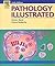 Pathology Illustrated