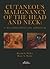Cutaneous Malignancy of the...