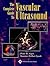 The Complete Guide to Vascular Ultrasound
