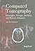 Computed Tomography Principles, Design, Artifacts, and Recent Advances