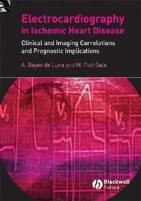Electrocardiography in Ischemic Heart Disease: Clinical and Imaging Correlations and Prognostic Implications (Hardcover)