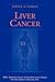Liver Cancer (MD Anderson S...