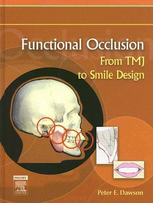 Functional Occlusion: From TMJ to Smile Design (Hardcover)