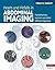 Pearls and Pitfalls in Abdominal Imaging: Pseudotumors, Variants and Other Difficult Diagnoses (Cambridge Medicine (Hardcover))