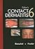 Fisher's Contact Dermatitis