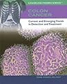 Colon Cancer: Current And Emerging Trends In Detection And Treatment (Cancer & Modern Science)