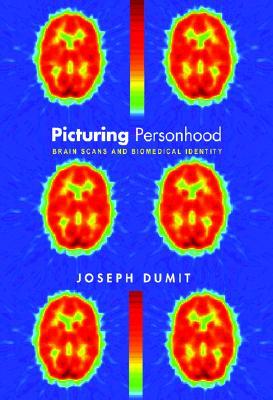 Picturing Personhood: Brain Scans and Biomedical Identity (In-Formation)