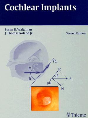 Cochlear Implants (Hardcover)