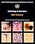 Pathology and Genetics of Skin Tumours (Medicine)