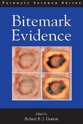Bitemark Evidence (International Forensic Science and Investigation)