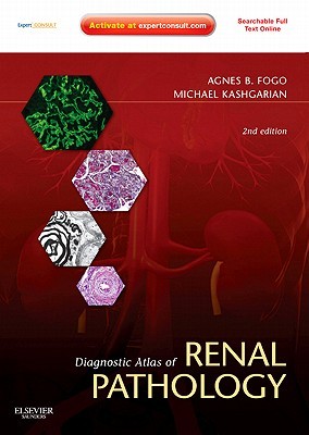 Diagnostic Atlas of Renal Pathology: Expert Consult - Online and Print (Hardcover)