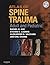 Atlas of Spine Trauma with CD-ROM by Alexander R. Vaccaro