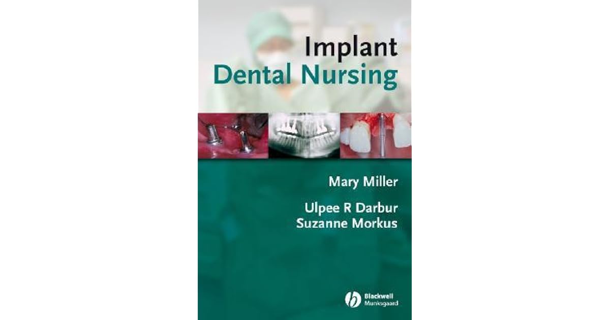 Implant Dental Nursing by Mary Miller
