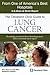 The Cleveland Clinic Guide to Lung Cancer
