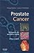 Prostate Cancer: Dana-Farber Cancer Institute Handbook (Dana-Farber Cancer Institute Handbooks)