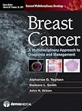Breast Cancer: A Multidisciplinary Approach to Diagnosis and Management