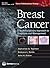 Breast Cancer: A Multidisci...