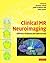 Clinical MR Neuroimaging: Diffusion, Perfusion and Spectroscopy