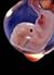 Basic Obstetrics