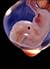 Basic Obstetrics