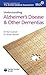 Understanding Alzheimer's D...