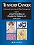Thyroid Cancer: A Comprehensive Guide to Clinical Management