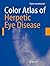 Color Atlas of Herpetic Eye Disease: A Practical Guide to Clinical Management