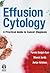 Effusion Cytology: A Practical Guide to Cancer Diagnosis