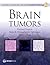 Brain Tumors (Consultant Pathology)