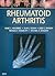 Rheumatoid Arthritis